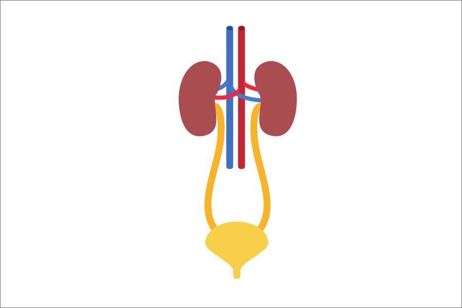 Bladder Exstrophy