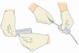suprapubic catheter