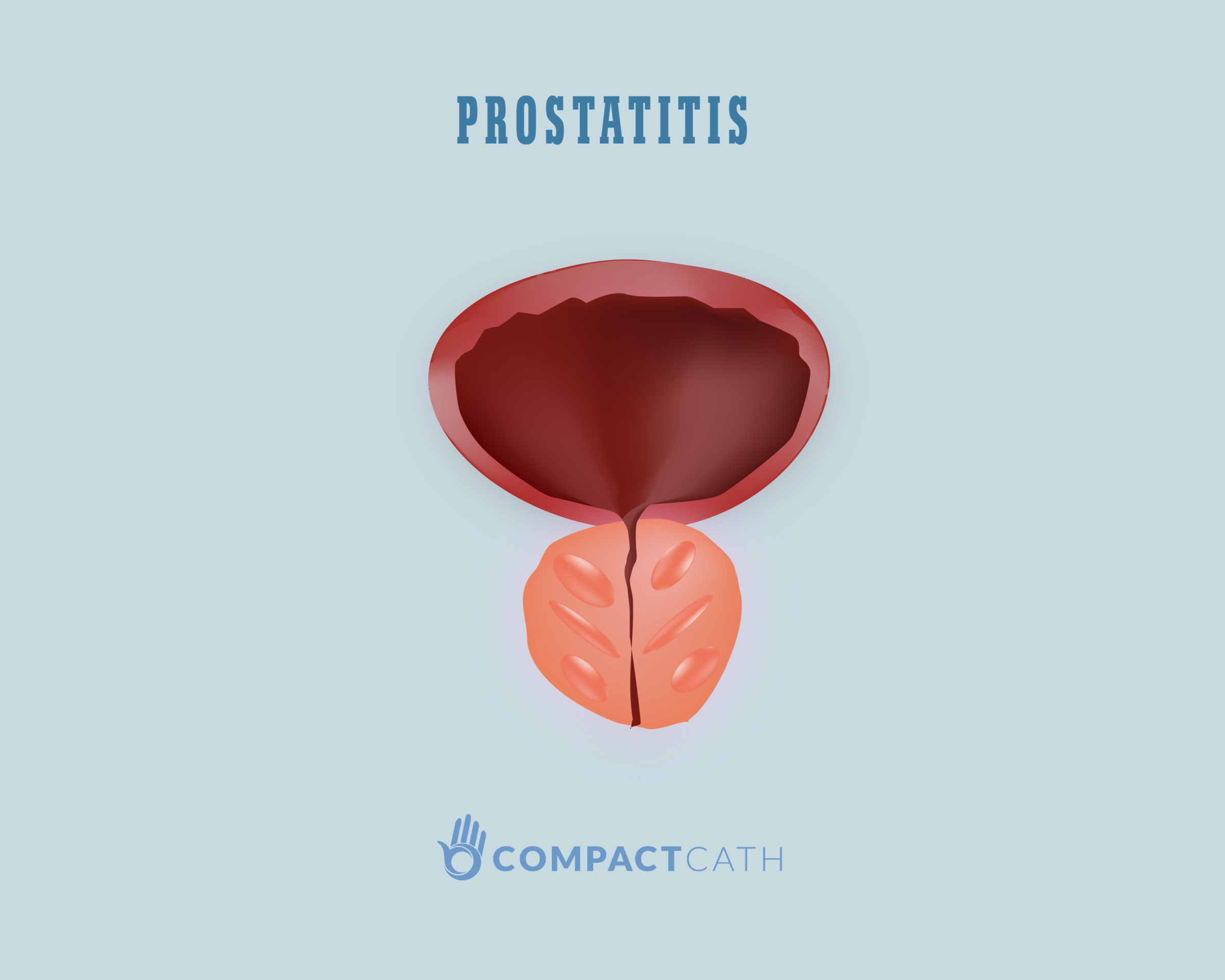 Ureaplasmosis prostatitis