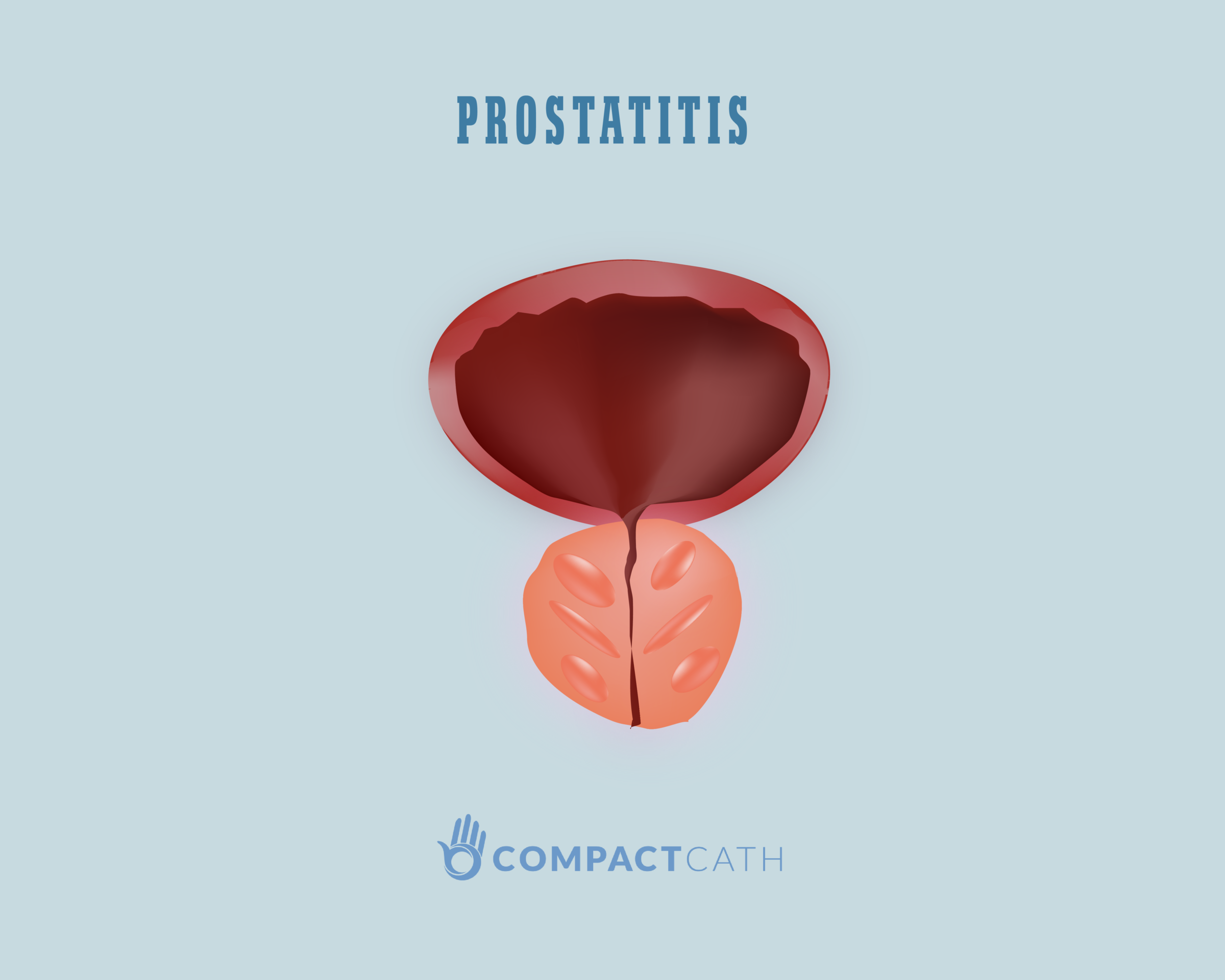 Prostatitis 1- 2 fok)